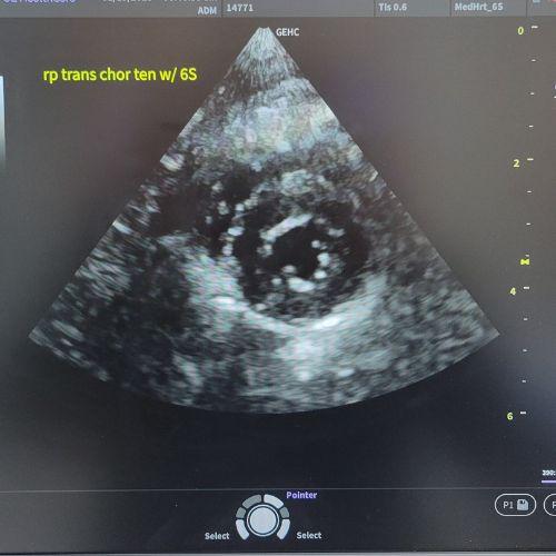 Cardiac ultrasound dogs